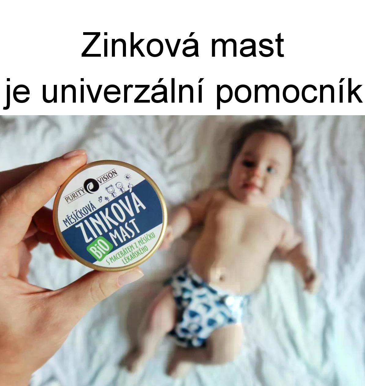 Zinková mast je univerzální pomocník