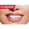 vyrp11 8706colgate optic white
