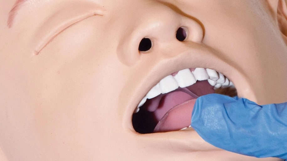 simjunior_tongueedema2