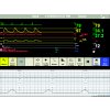 Patient Monitor 800x600 b523560