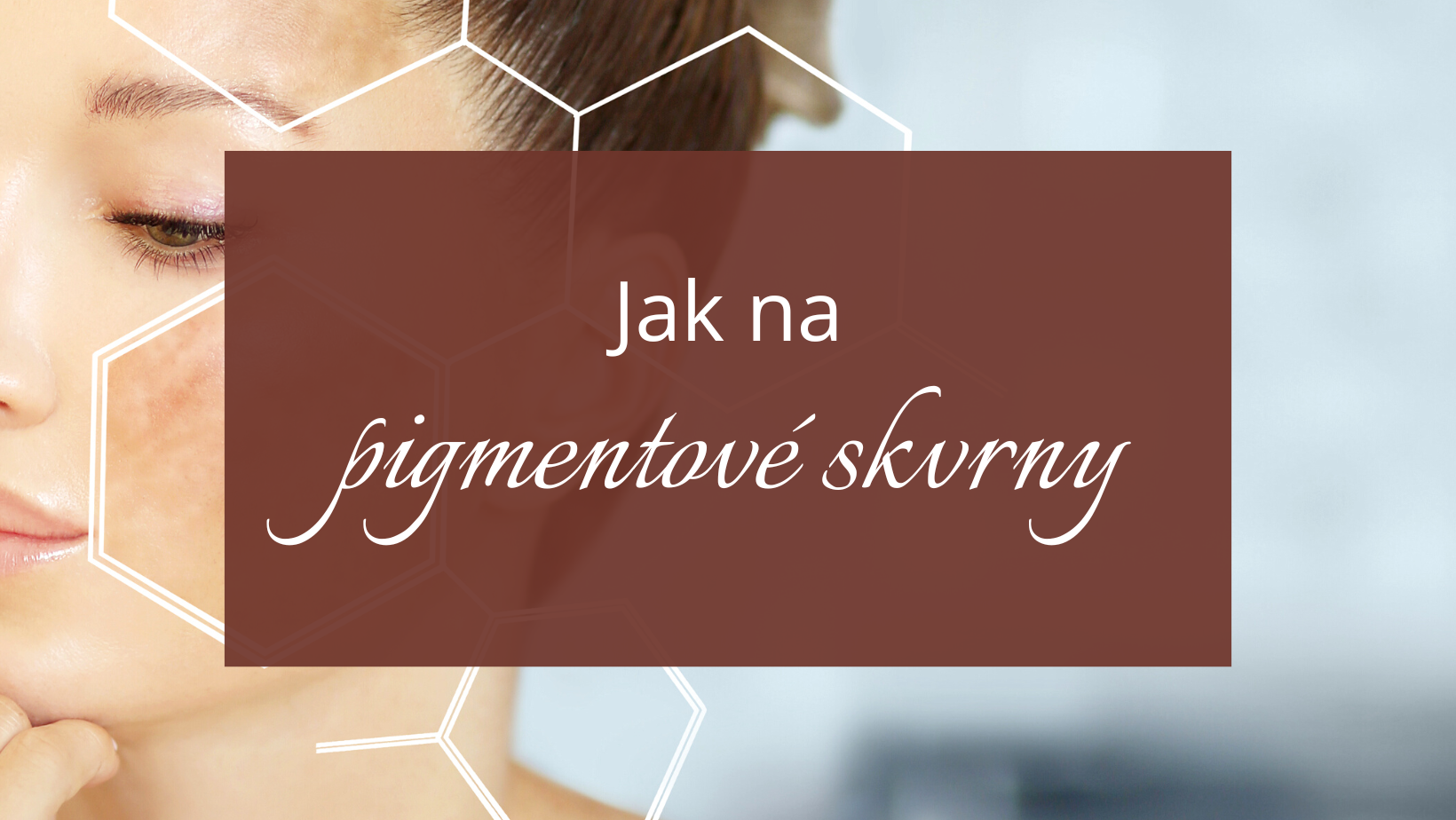 Proč se tvoří pigmentové skvrny a jak proti nim bojovat?