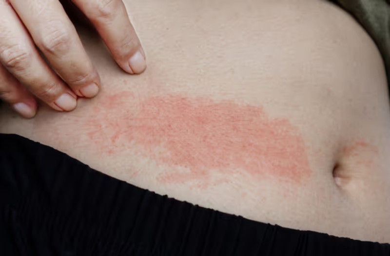 Starostlivosť o citlivú pokožku v zime