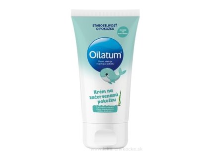 Oilatum krém na začervenanú pokožku 100 ml