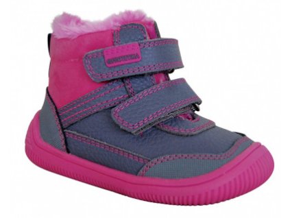 Protetika Tyrel fuxia č.32