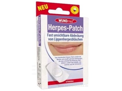 WUNDmed Náplasť na herpes 6 ks