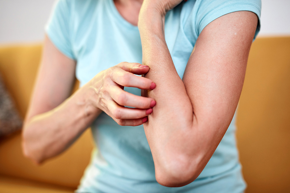 In the case of acute inflammation on the skin, a bite from a venomous or infected mosquito, tick, jellyfish, burn, or allergic eczema.