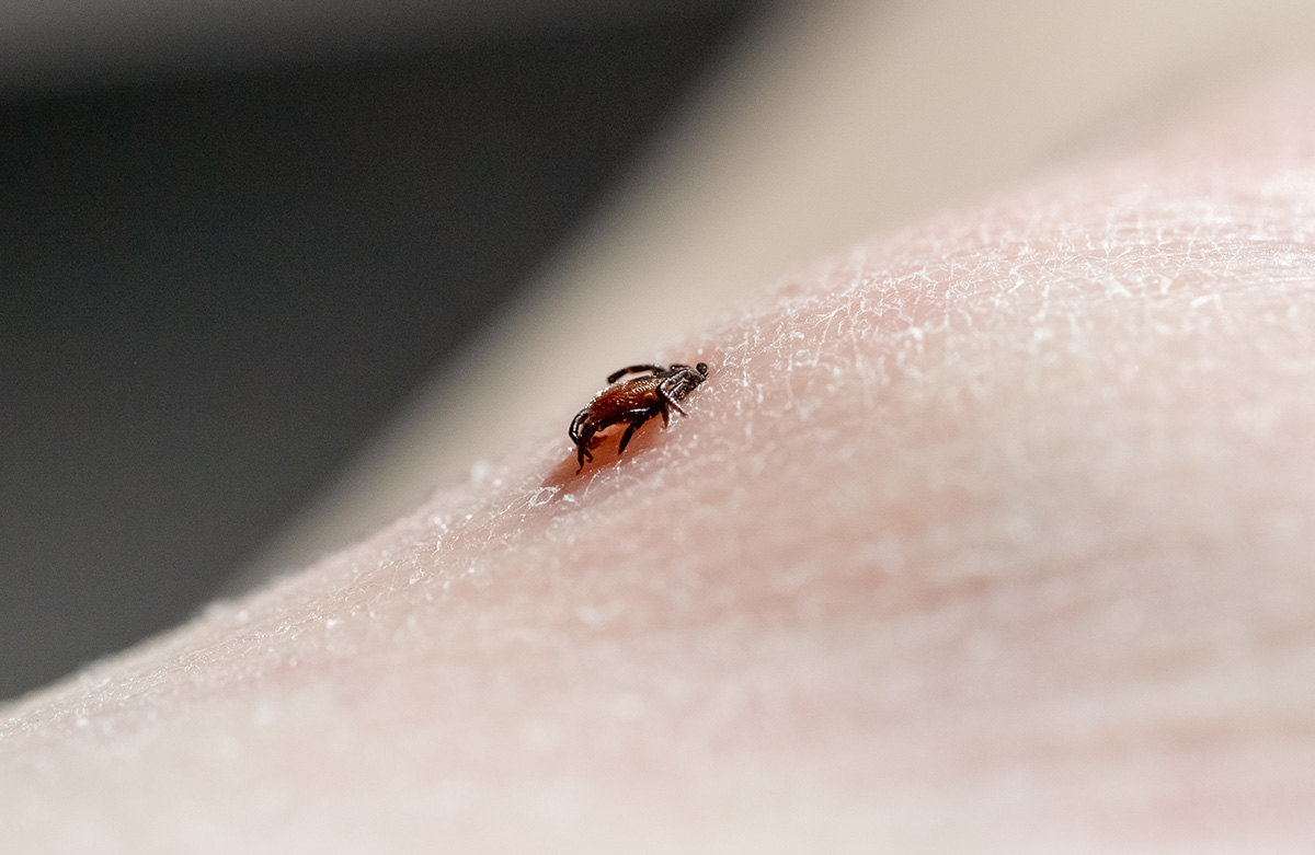 Ticks, encephalitis, meningitis - prevention and care