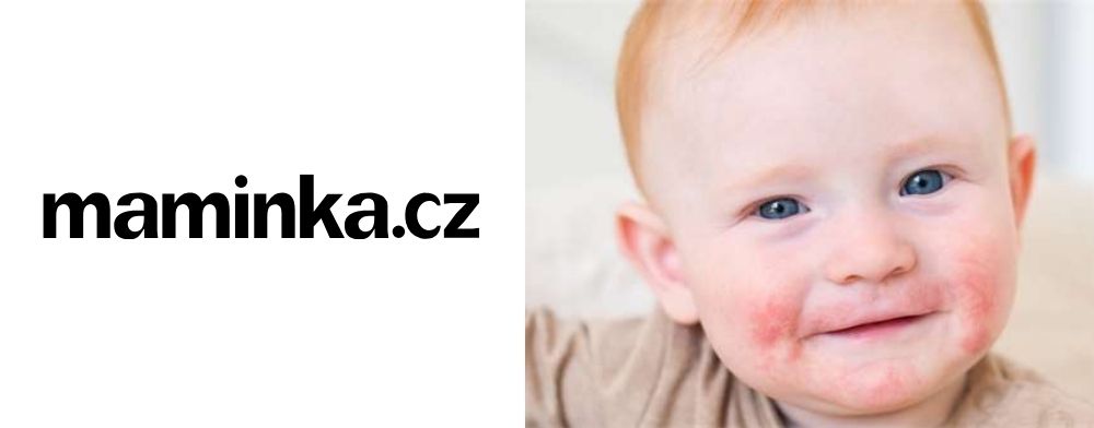 Má vaše dieťa atopický ekzém? Riešením nemusia byť kortikoidy. Skúste levanduľu alebo pohánku a ovos