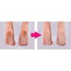 Callous Remover H-1501