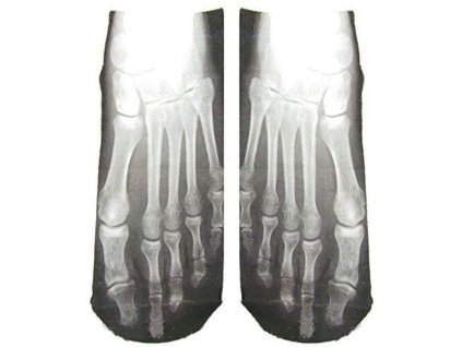 5072 1 ponozky kostra 2