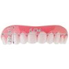 16971 1 silikonova horni zubni proteza 1
