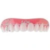 8228 silikonova horni zubni proteza 1