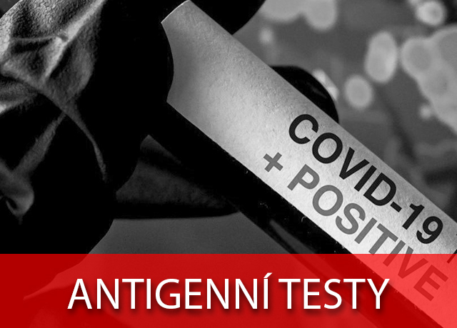 Antigenní testy