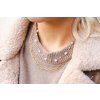 8332 3 nahrdelnik z chirurgicke oceli rose