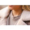 8332 4 nahrdelnik z chirurgicke oceli rose