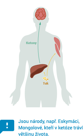 Ketóza a hubnutí | Ketóza je přirozený stav těla, díky kterému hubněte snadno a pohodlně