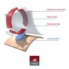 Wickelbody Set Langarm Outlast® - Hellaltrosa