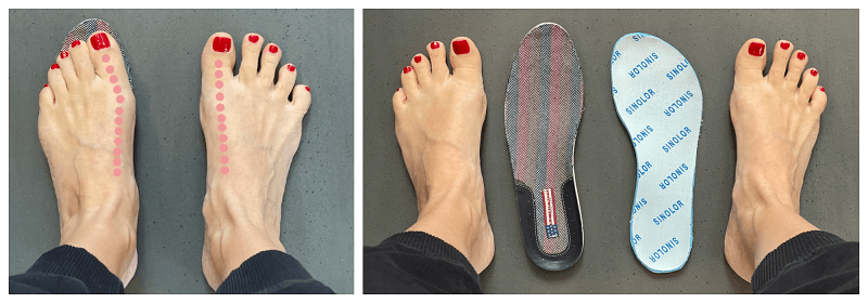 Běžné vs. barefoot topánky