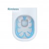 Rimless