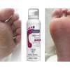 Footlogix Peeling Skin Formula (7) - pěna pro loupající se pokožku, 125 ml (4.2 oz.)