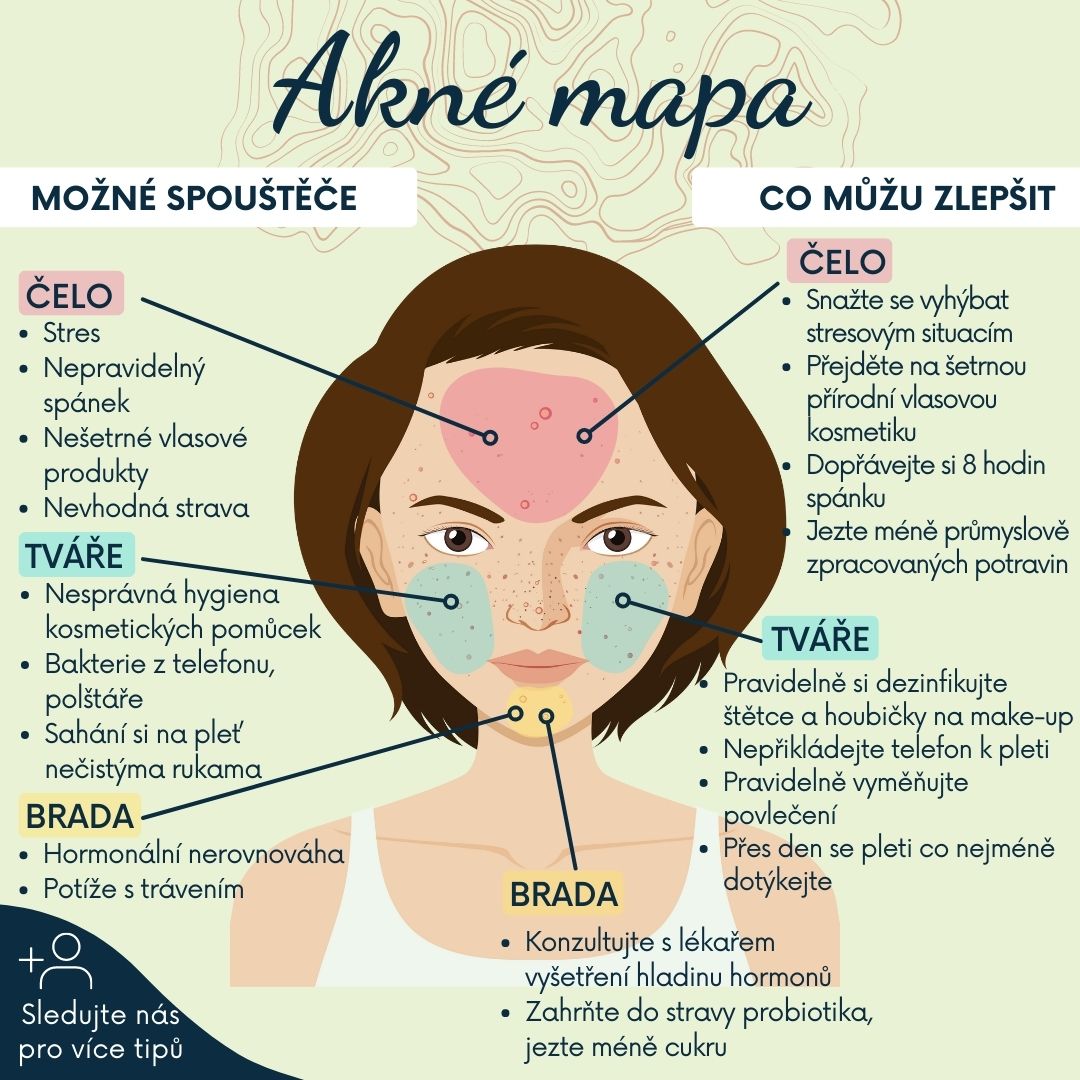 Co je příčinou akné?