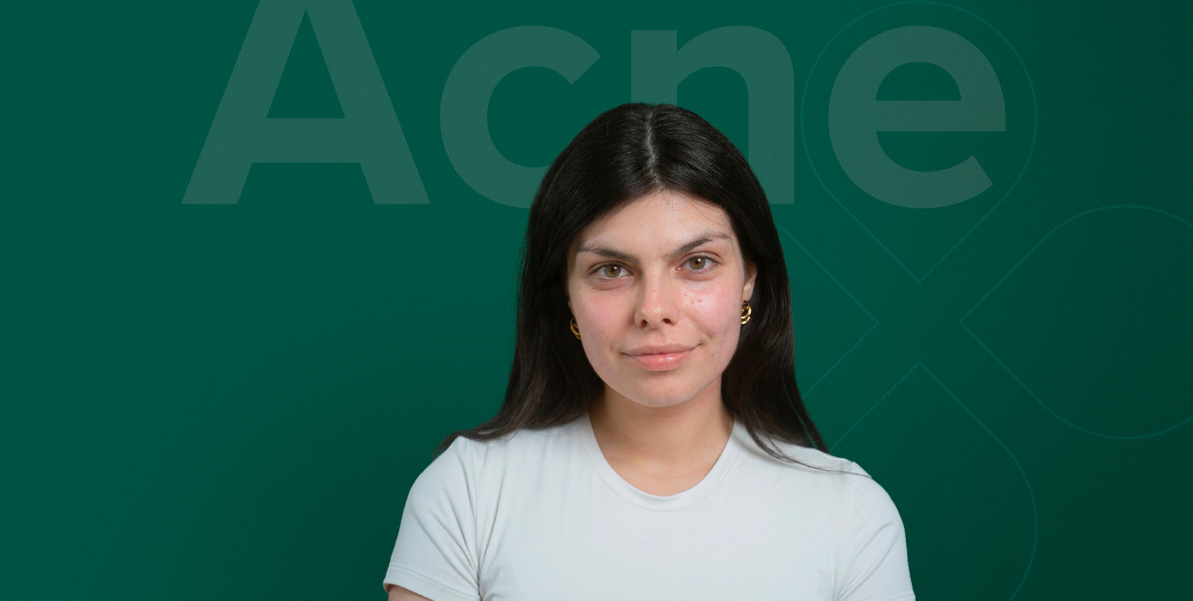 Akné rutina s LOBEY