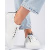 Dierkované biele dámske tenisky s trblietkami