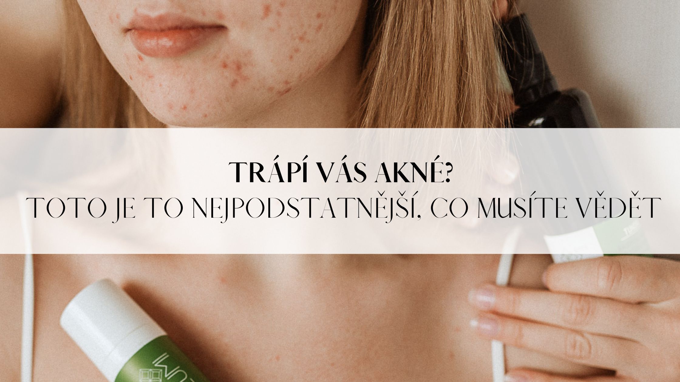 Akné - to nejpodstatnější, co byste měli vědět.