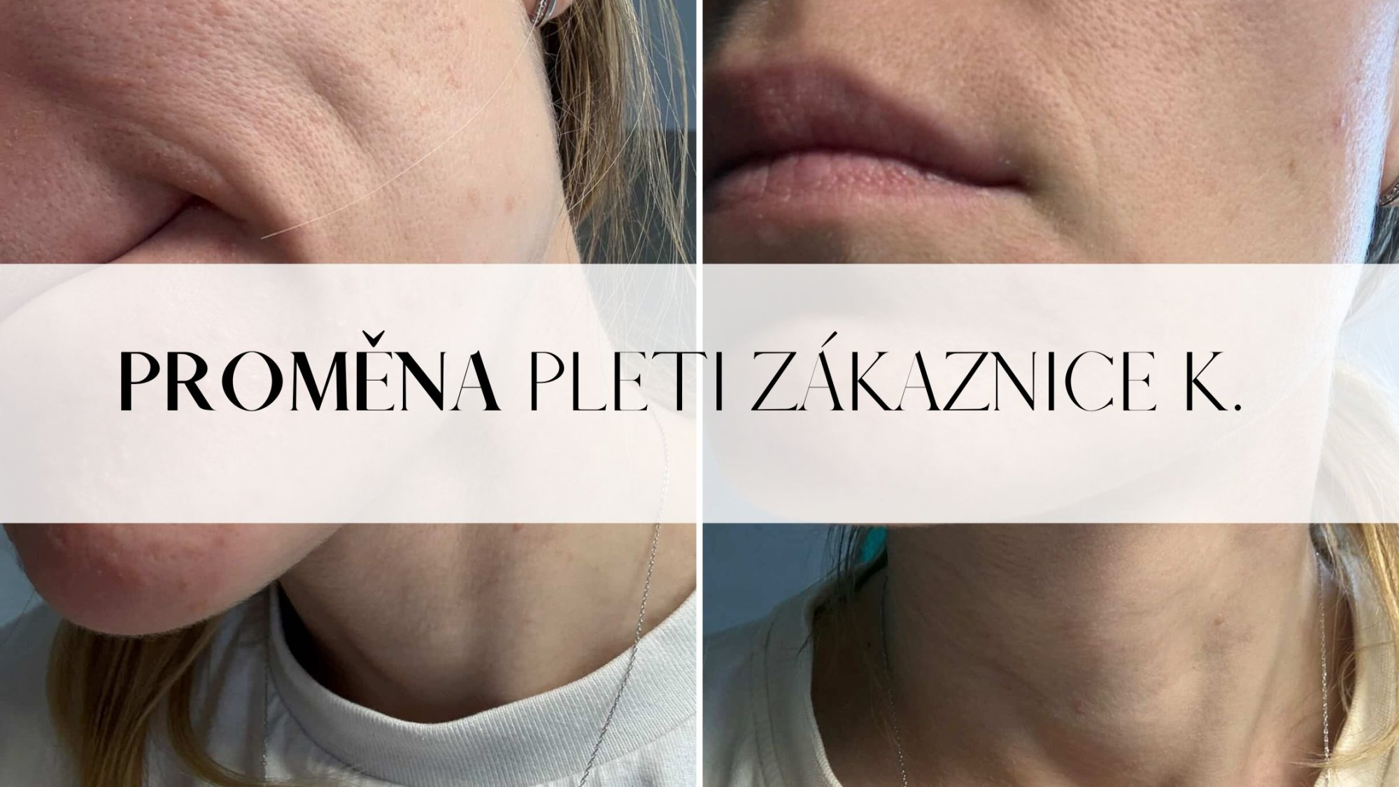 Proměna pleti zákaznice K.