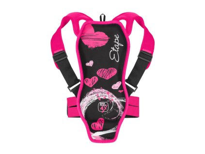 etape backbone 2395312