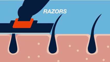 Razor