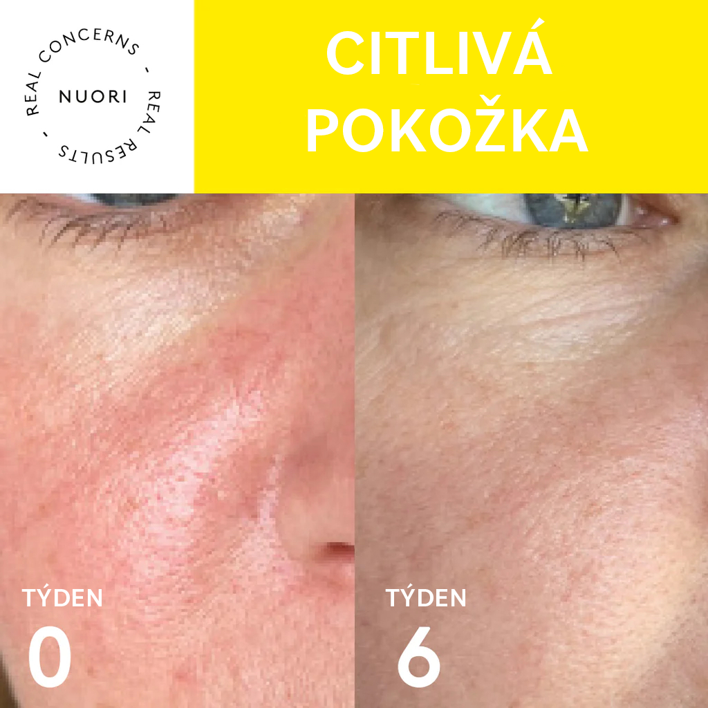 Řešení hlavních problémů s pletí přírodní cestou_1