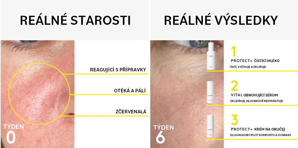 Řešení hlavních problémů s pletí přírodní cestou_2