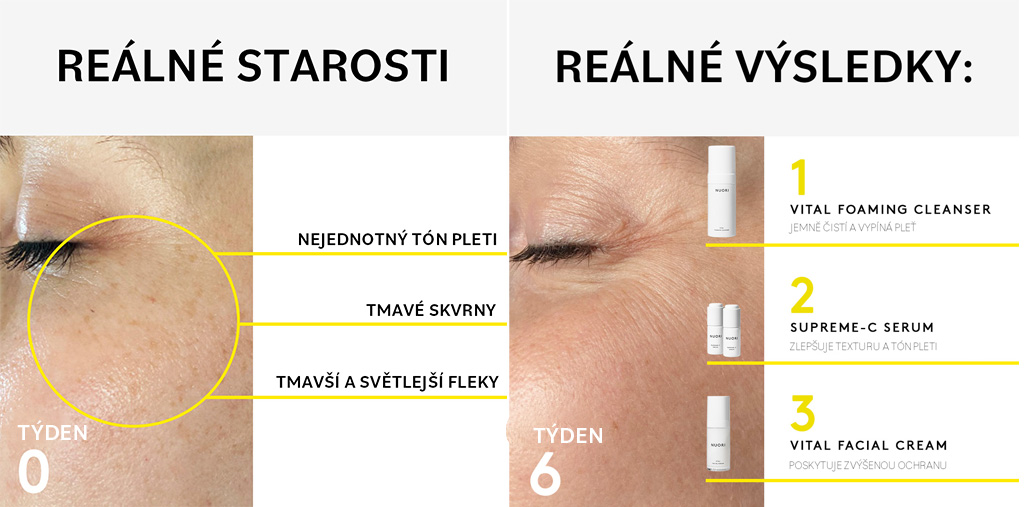 Řešení hlavních problémů s pletí přírodní cestou_6