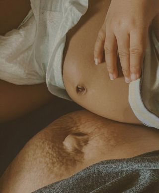 Tělo po těhotenství a porodu nese příběh. Příběh síly, proměny, nového začátku. Někdy zůstane jiný tvar, jiná kůže, jiný...