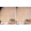 Essential Fx Deep Crease Serum Composed B&A Preferred 1920x1080