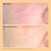 INFOGRAFIKA FIRMING CREAM KRÉM NEUROPEPTIDY (1)