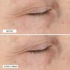Essential Fx Rejuvenating Moisturizer B&A Sub18 1 2000x2000