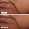 Essential Fx Rejuvenating Moisturizer B&A Sub15 2 2000x2000