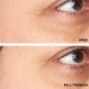 PRZED i PO 1