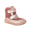 divci barefoot zimni boty protetika nut pink
