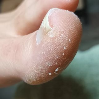 Jak vypadají vaše nohy po letní sezóně? Také nosíte v létě gellaky na nehtech? Ano, je to pohodlné a hezké. Ale nehty...