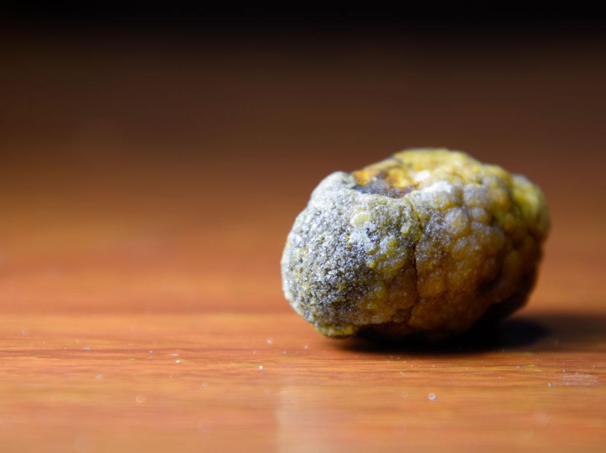 Rastlina ktorá rozpúšťa žlčové kamene: Bylinky na žlčník