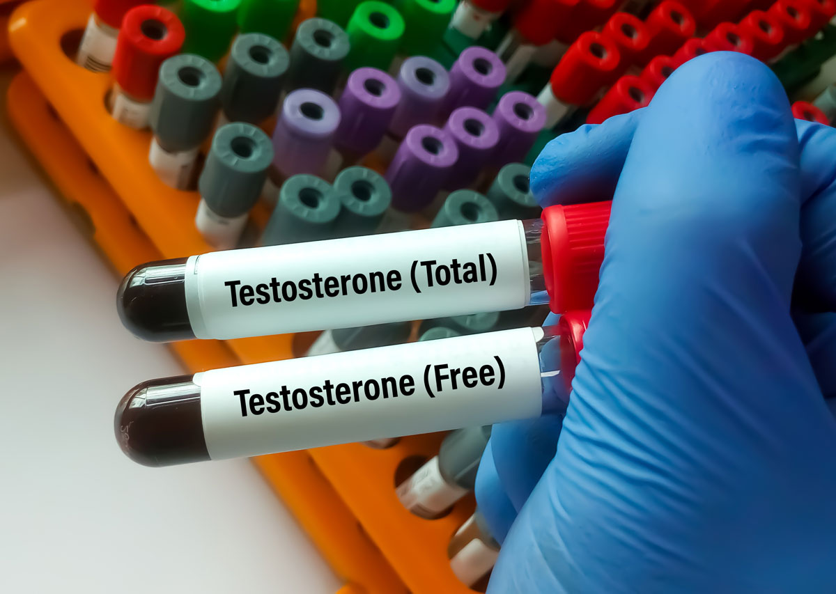 testosteron-test_1