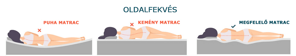 oldalfekves