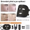 MATYZ  BP VS47 Led fotonová maska na obličej a krk