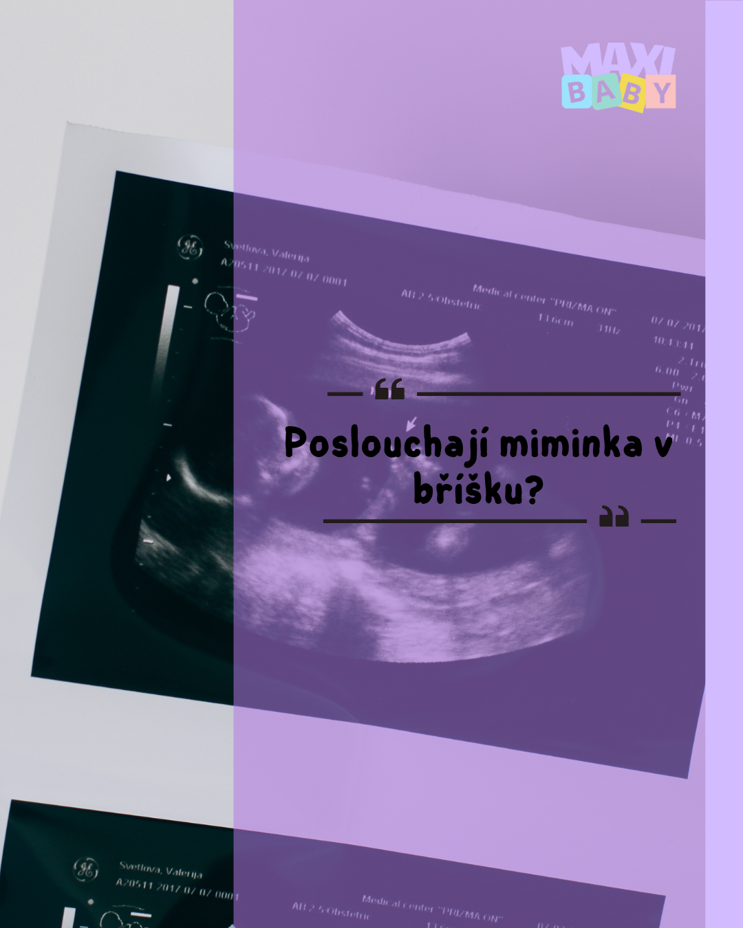Slyší miminko v bříšku?