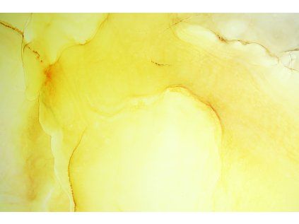 U ABS 000149