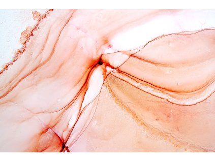 U ABS 000170