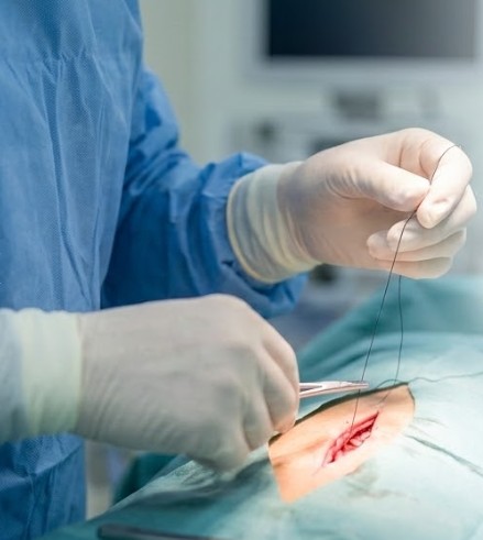 Jak vybrat správné chirurgické šití Medipac: Komplexní průvodce pro profesionály